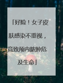 好险！女子皮肤感染不重视，竟致颅内脓肿危及生命
